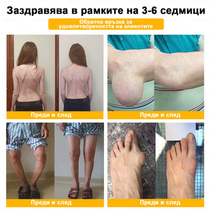 ✨✨𝑋𝑅𝐿𝑋𝑅𝐿® Болеутолителен крем с пчели яд и лечение на кости (Специално за възрастни хора и препоръчан от PTOT)