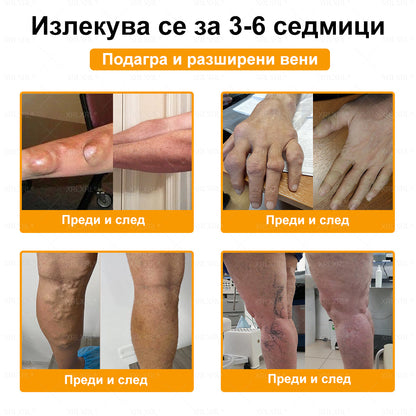 ✨✨𝑋𝑅𝐿𝑋𝑅𝐿® Болеутолителен крем с пчели яд и лечение на кости (Специално за възрастни хора и препоръчан от PTOT)