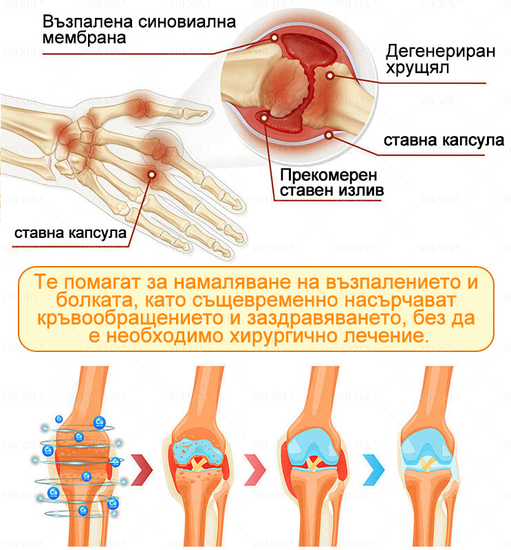 ✨✨𝑋𝑅𝐿𝑋𝑅𝐿® Болеутолителен крем с пчели яд и лечение на кости (Специално за възрастни хора и препоръчан от PTOT)