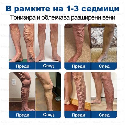 🧬✅Moauou® GHK-Cu Микроиглен регенериращ пластир –  по-малко подуване, по-леки крака и по-малко видими вени още в рамките на 7–14 дни⚡