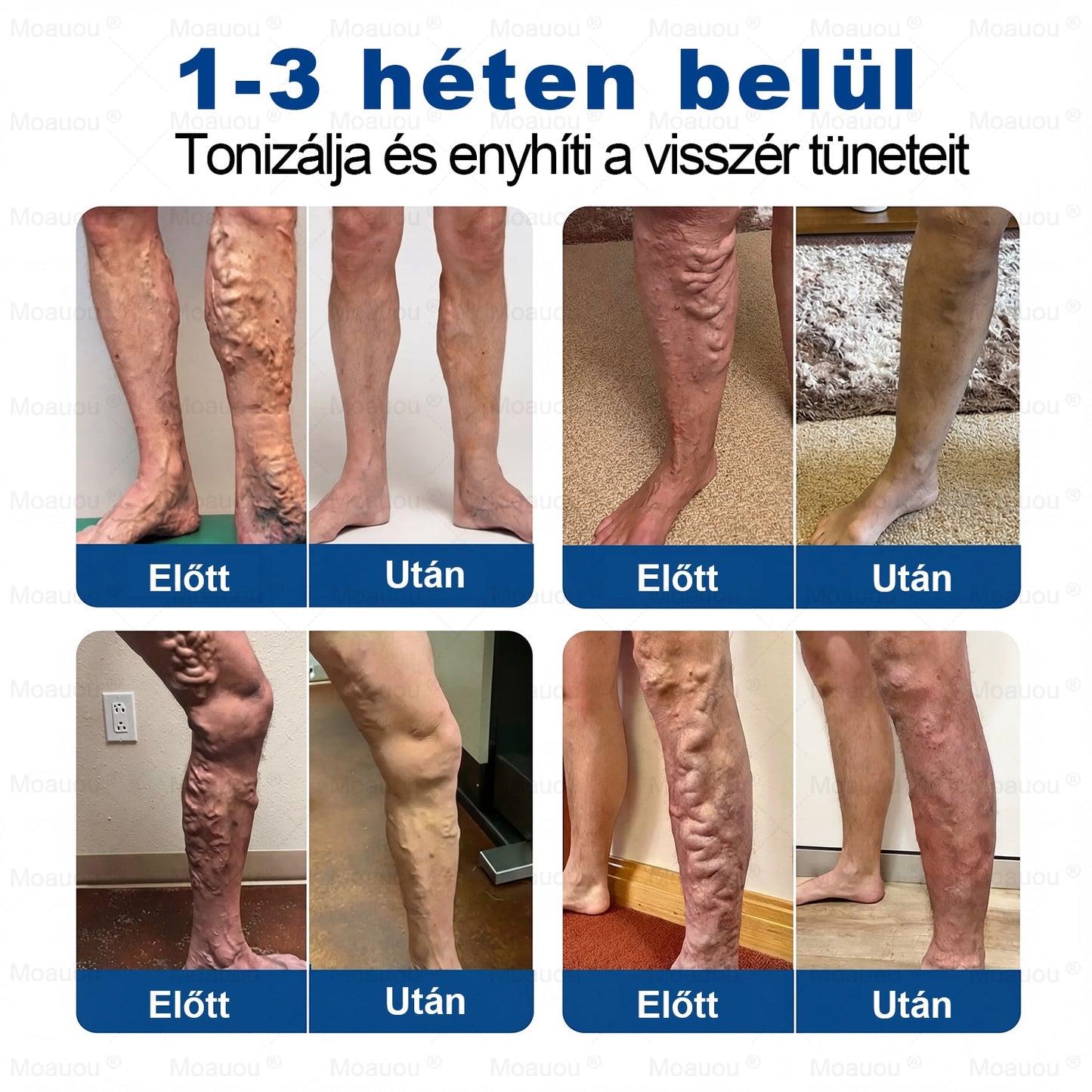 🎉🎁 Moauou® GHK-Cu mikroigelni regenerativni obliž⚡ Takojšnje olajšanje, dolgotrajni rezultati – VELIKA AKCIJA!
