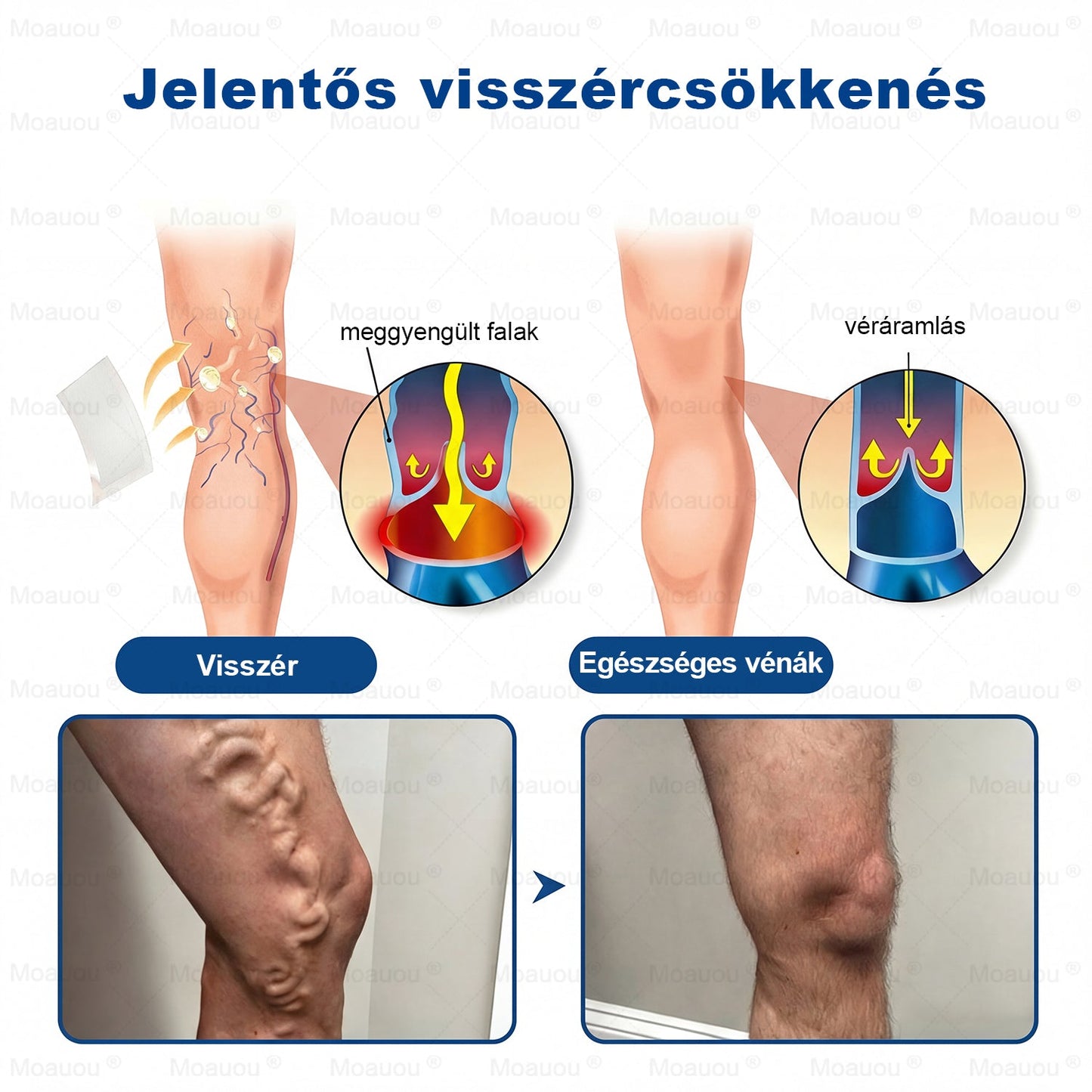 🎉🎁 Moauou® GHK-Cu mikroigelni regenerativni obliž⚡ Takojšnje olajšanje, dolgotrajni rezultati – VELIKA AKCIJA!