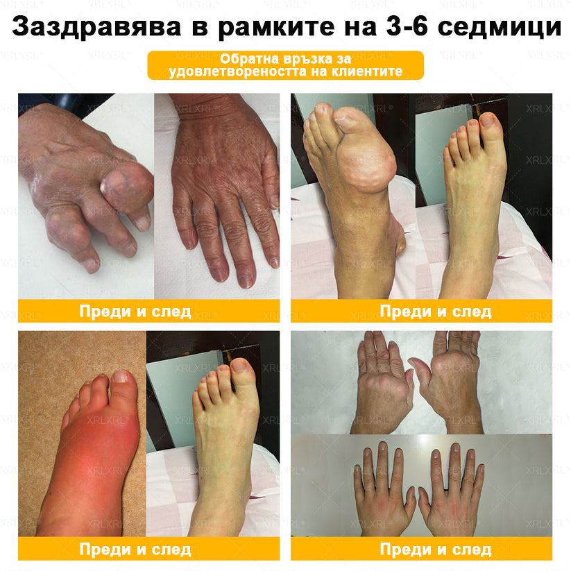 ✨✨𝑋𝑅𝐿𝑋𝑅𝐿® Болеутолителен крем с пчели яд и лечение на кости (Специално за възрастни хора и препоръчан от PTOT)