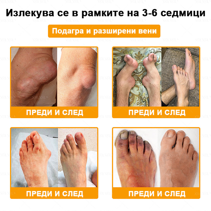 ✨✨𝑋𝑅𝐿𝑋𝑅𝐿® Болеутолителен крем с пчели яд и лечение на кости (Специално за възрастни хора и препоръчан от PTOT)